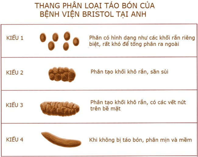 Hình dạng phân khi trẻ bị táo bón